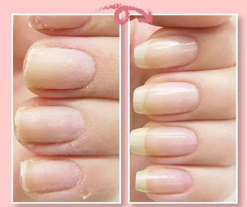 50% Korting | NailRepair™ - Instant nagelbeschermingsgel